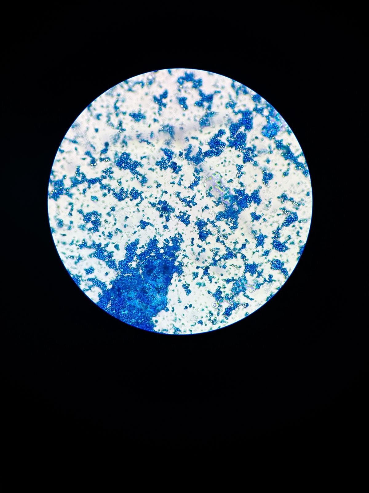 MICROLOT BOURBON AMARILLO by Wilton Benitez